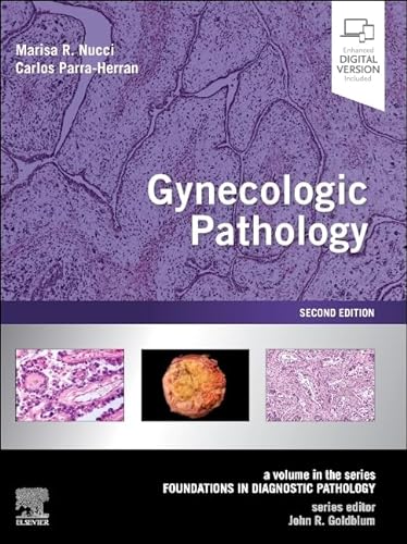 Gynecologic Pathology: A Volume in Foundations in Diagnostic Pathology Series von Elsevier